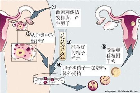 有偿同志供卵咨询怎么找
